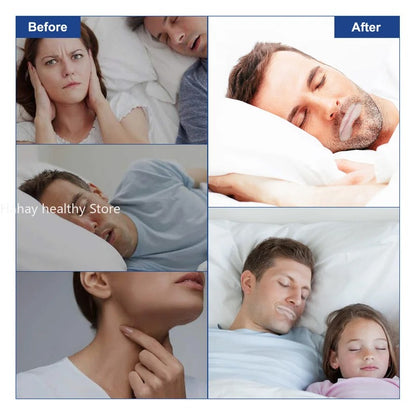 Mouth Tape (Sleeping Tape)